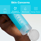Paula's Choice CLEAR Anti-Redness Exfoliating Solution, 2% Salicylic Acid Liquid Exfoliant for Face, Face Exfoliant for Mild to Severe Acne & Breakouts, Blackhead-Prone Skin, Fragrance-Free