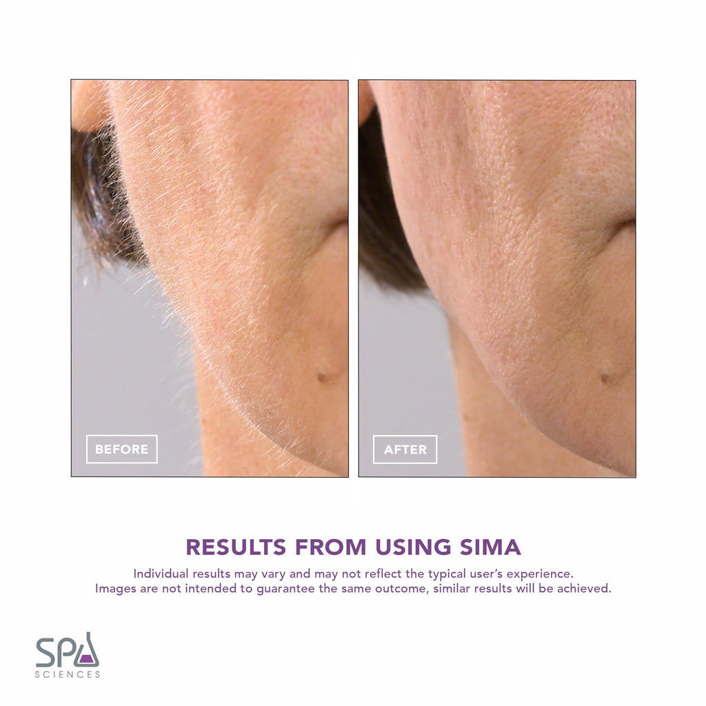 SPA SCIENCES - SIMA Patented Dermaplane Razor for Women Face – Painless 2-in-1 Facial Exfoliation & Peach Fuzz Hair Removal – Anti-Aging – 3 Speeds – Rechargeable – 7 Weeks Treatment