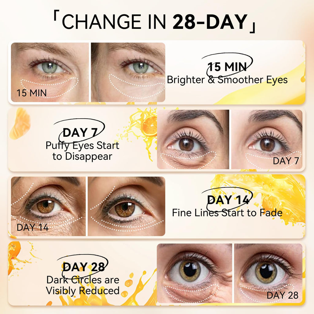 LANBENA Vitamin C Under Eye Patches for Dark Circles and Puffy Eyes, Cooling Eye Masks for Eye Bags, Fine Lines & Wrinkles Reduce, Anti-Aging, with Niacinamide Hydra-Gel Collagen-30 Pairs