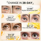 LANBENA Vitamin C Under Eye Patches for Dark Circles and Puffy Eyes, Cooling Eye Masks for Eye Bags, Fine Lines & Wrinkles Reduce, Anti-Aging, with Niacinamide Hydra-Gel Collagen-30 Pairs