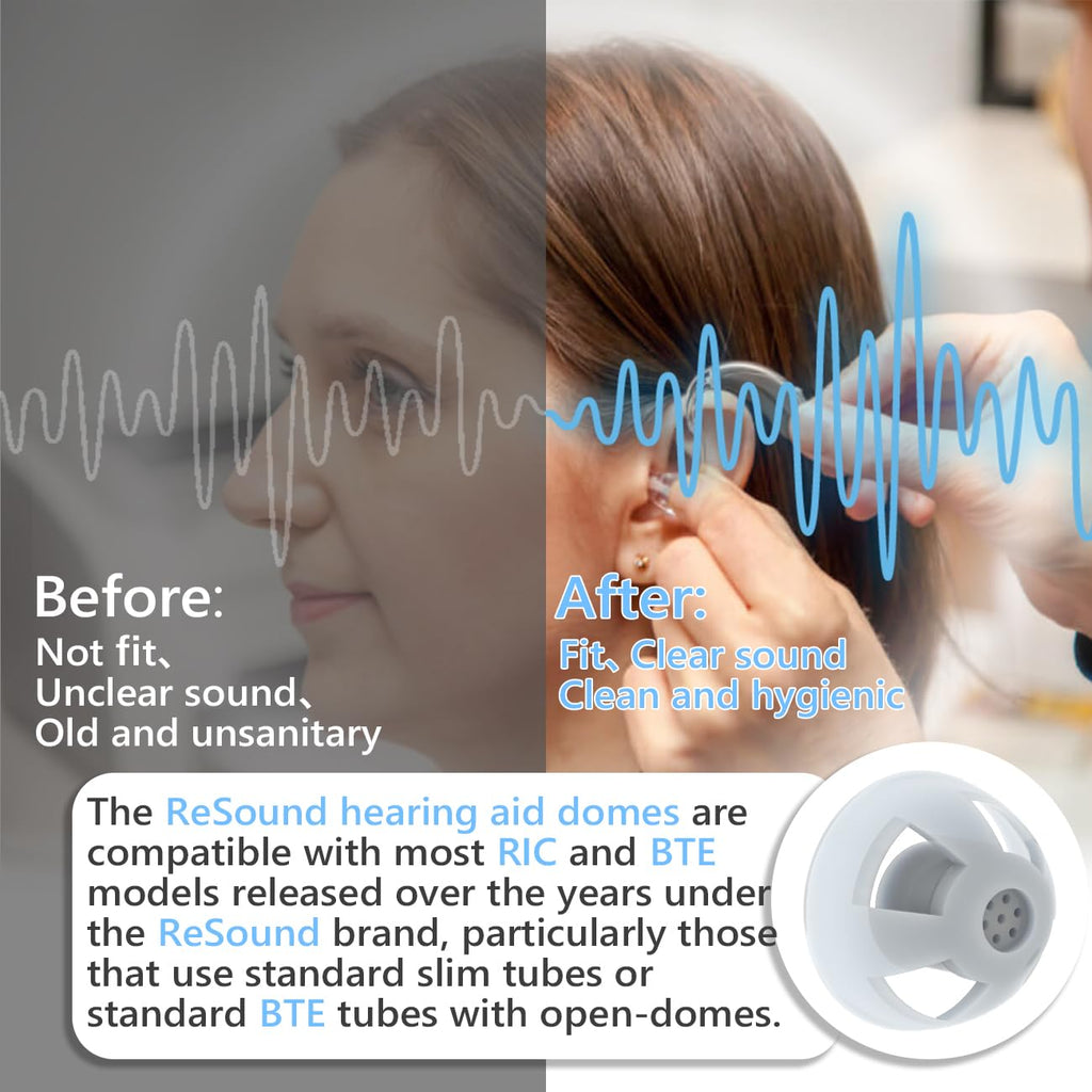 20pcs GN Resound Hearing aid Domes Open(M Size 8mm) Comfortable Silicone Design Noise Reduction Enhanced Acoustics Breathable and Easy to Clean Resound Hearing Aid Accessories Jabra Hearing Aid Domes