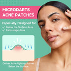 TEAWOO 72-Count Microdart Acne Patches, Hydrocolloid Pimple Patches with Salicylic Acid & Madecossoside, Microdart Zit Patches for Deep Blemishes & Early Stage Acne (Patented)