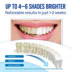 Teeth Whitening Pen Gel Kit: 35% Carbamide Peroxide Gel for Stain Removal - No Sensitivity with Remineralizing Pen for a Brighter Whiter Smile Mint (5 Pack)