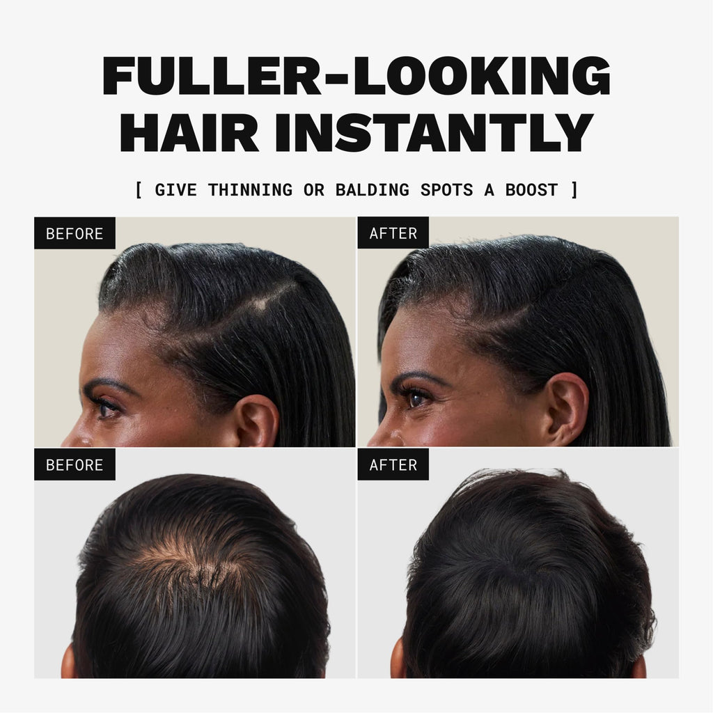 Toppik Hair Building Fibers, Dark Brown, 12g Fill In Fine or Thinning Hair, Instantly Thicker, Fuller Looking, 9 Shades for Men & Women, Keratin Protein Formula