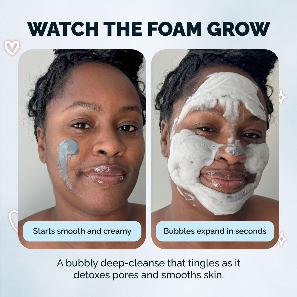 Elizabeth Mott Carbonated Bubble Detox Clay Mask – Korean Skincare for Deep Pore Cleansing, Acne, Blackheads & Oil Control – Charcoal Face Mask for Breakouts & Smooth Skin – Cruelty-Free, 3.53 oz