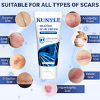 Kunyle Scar Cream, Silicone Scar Gel, Advanced Scar Removal Cream for Surgical Scars, Stretch Marks Removal, Keloid Bump Removal, Old and New Scars 2.11 Oz (60g)