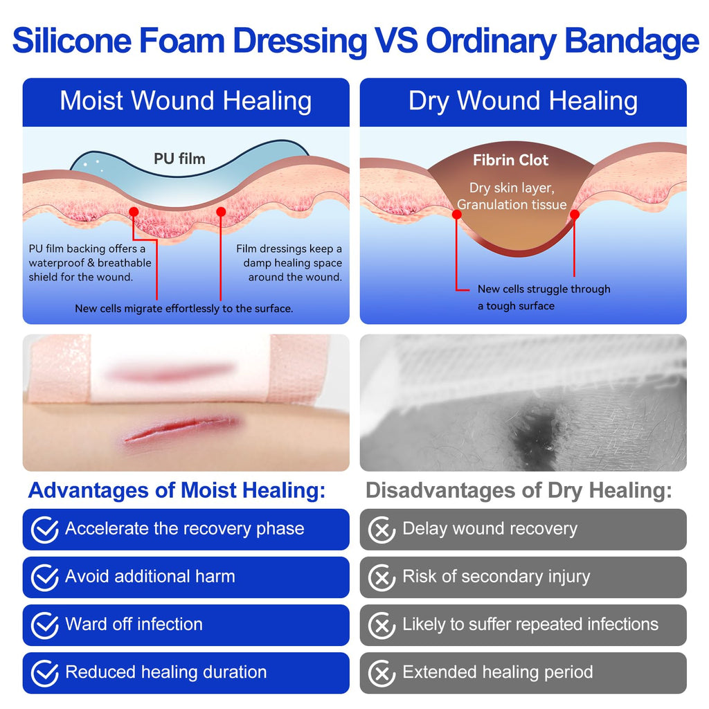Silicone Foam Dressing 4"x4"(10 PCS), Waterproof Silicone Large Bandages for Wound with Border Adhesive, High Absorbency Bed Sore Bandages Wound Care Dressing (2.5"X2.5" Pad)