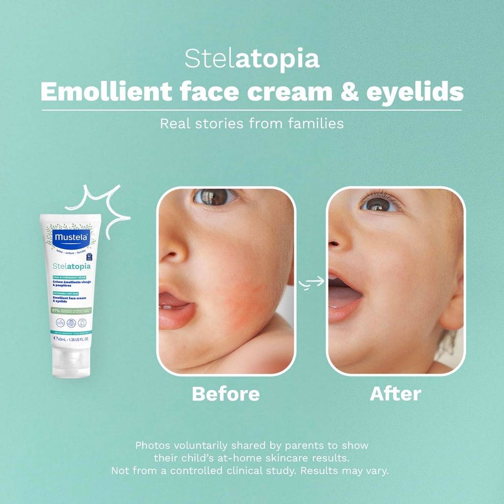 Mustela Stelatopia Eczema-Prone Skin Emollient Baby Face Cream - Face Moisturizer with Natural Avocado & Sunflower Oil - Fragrance-Free - 1.35 fl. oz.