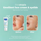 Mustela Stelatopia Eczema-Prone Skin Emollient Baby Face Cream - Face Moisturizer with Natural Avocado & Sunflower Oil - Fragrance-Free - 1.35 fl. oz.
