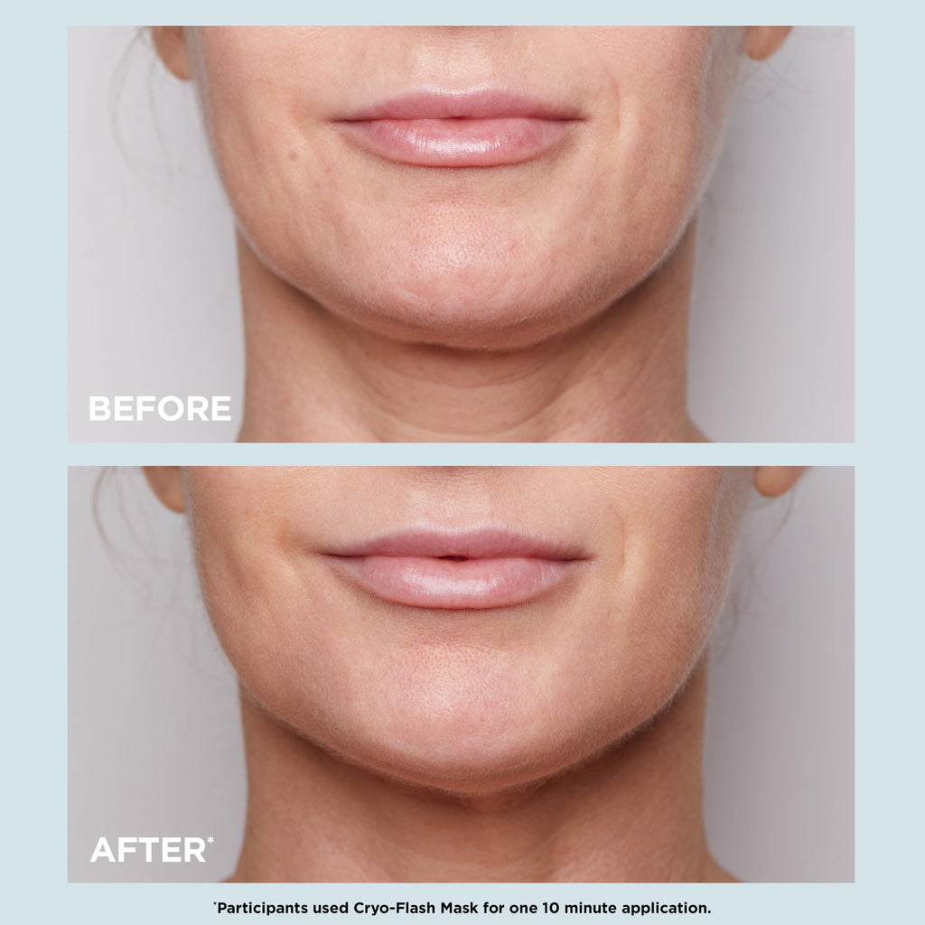 CLARINS Cryo-Flash Face Mask | Visible Lift Effect in 10 Minutes* | Visibly Minimizes Pores | Boosts Radiance | Pro Like Results | All Skin Types | 2.5 Fluid Ounces