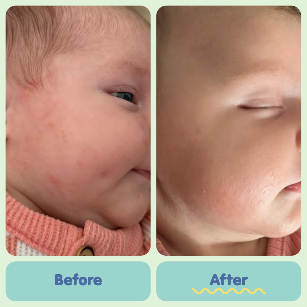 TUBBY TODD All Over Ointment - Baby Eczema Cream, Everyday Multi-Purpose Sensitive, Dry, Irritation Baby Skin Relief Cream, Steroid & Gluten Free, Fragrance Free - 1 Pack, 8 Oz