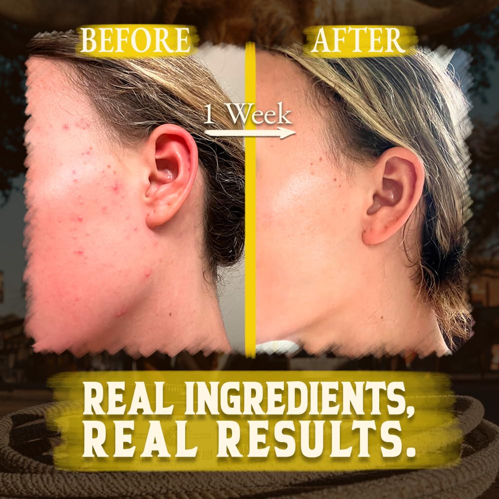 Organic Beef Tallow for Skin - 4 OZ (Citrus) — Grass Fed Beef Tallow for face + Body — US-Made Whipped Tallow and Honey Balm Moisturizer for Dry and Sensitive Skin, Eczema, Rosacea (No Additives)