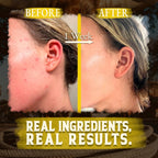 Organic Beef Tallow for Skin - 4 OZ (Citrus) — Grass Fed Beef Tallow for face + Body — US-Made Whipped Tallow and Honey Balm Moisturizer for Dry and Sensitive Skin, Eczema, Rosacea (No Additives)