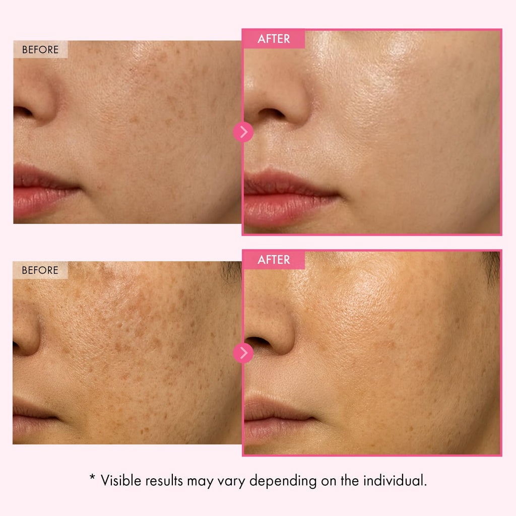 TOSOWOONG Arbutin 7% Glutathione Cream, 70,000ppm Arbutin + 5,001ppm Glutathione, Niacinamide, Dark Spots, Freckle, Blemishes, Pigmentation, Dullness, Uneven Tone, Korean Skin Care, 50ml, 1.69 fl.oz.