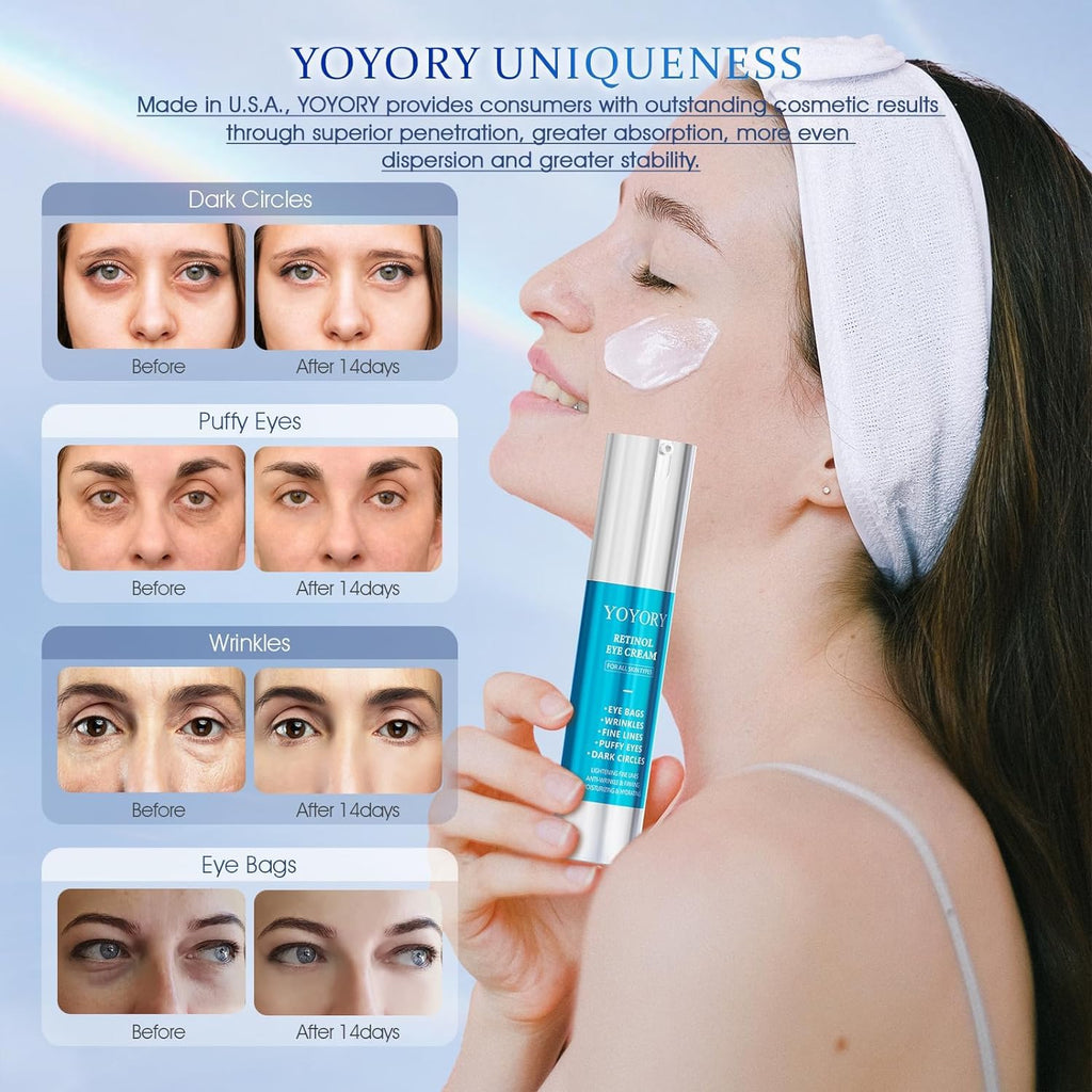Retinol Under Eye Cream - Anti Aging Eye Cream for Wrinkles, Fine Lines, Eye Bags,Dark Circles and Puffiness Treatment Skin Care Hydrates & Lifts (20ml)
