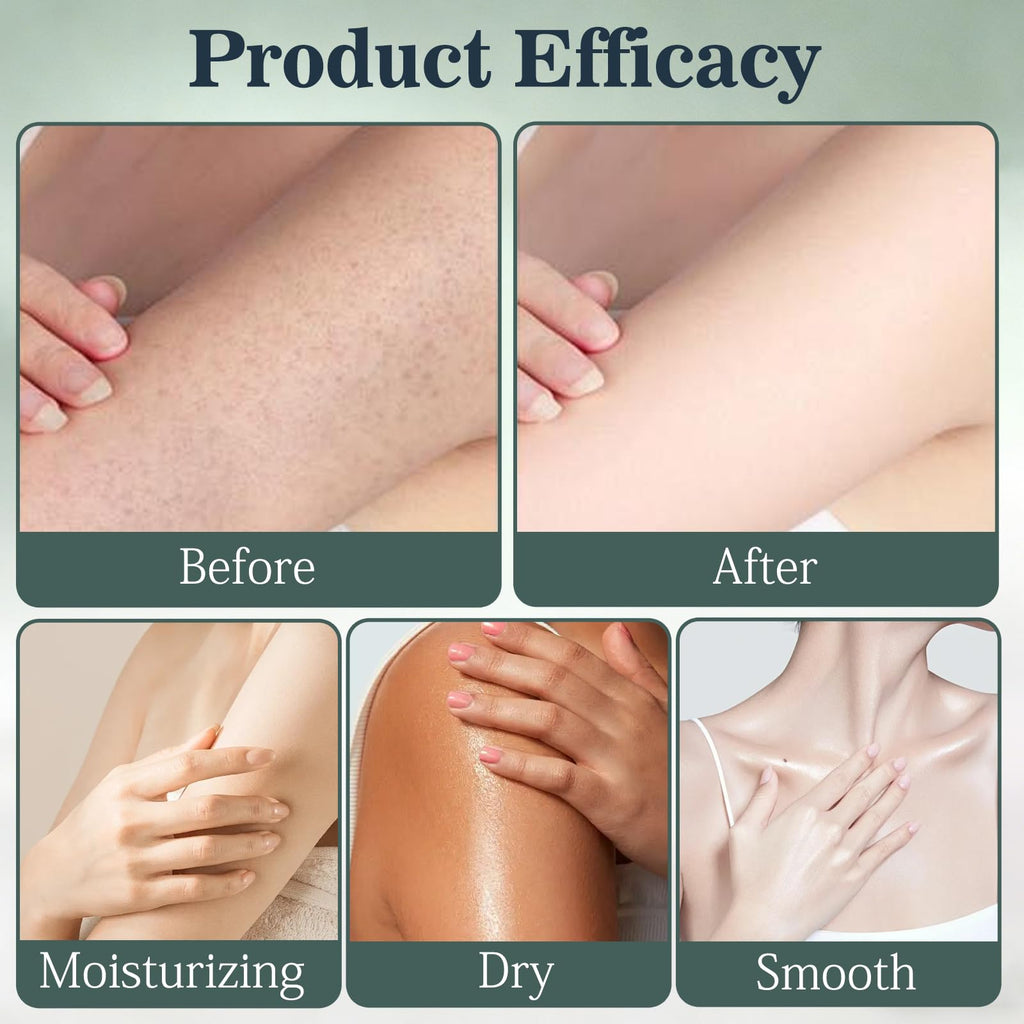 2026 New Intertrigo Cream, Professional Intertrigo Relief Cream, Skin Fold Care & Chafing Support Cream, Fast-Drying Non-Greasy Formula for Friction-Prone Areas (2Pcs)