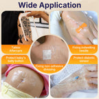 Transparent Film Dressing with Pad, 2.3" x 2.75", 50 Pack, Waterproof Patch