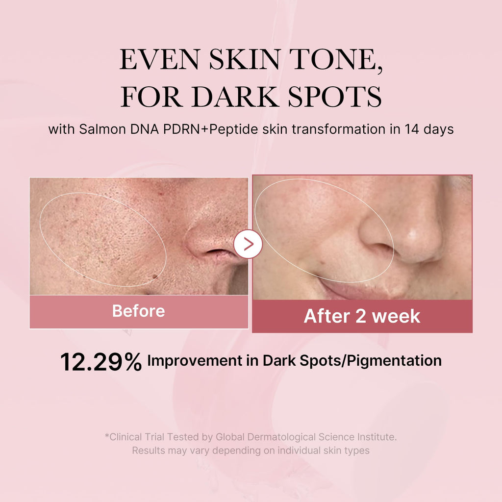 medicube PDRN Toner Salmon DNA PDRN CICA Soothing Toner | Lightweight & Watery for Skin Boosting, Soothing and Calming | Uneven Skin Tone Care with Peptide & Niacinamide | Korean Skincare, 8.45 fl.oz