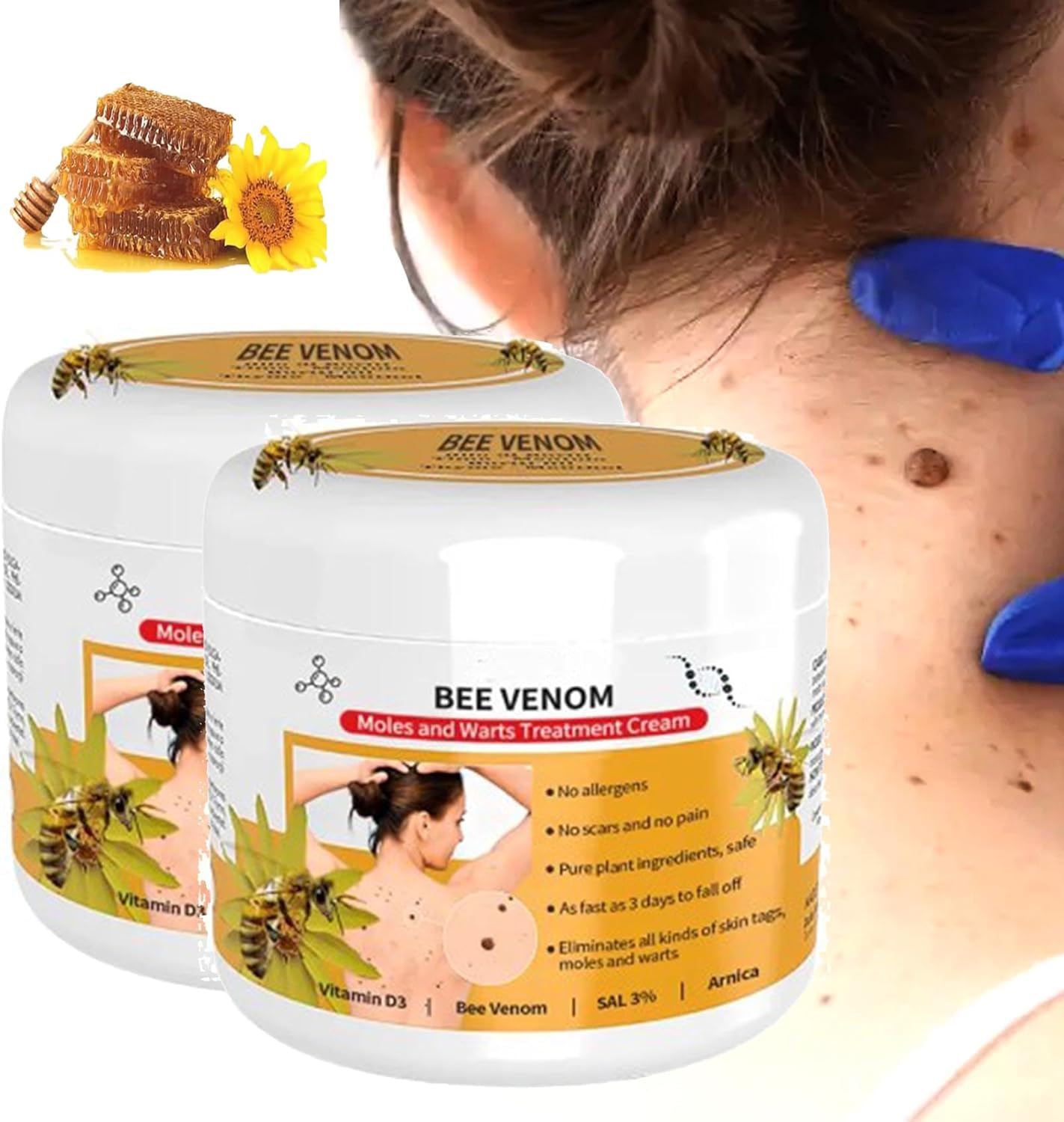 Bee Venom Moles and Warts Cream