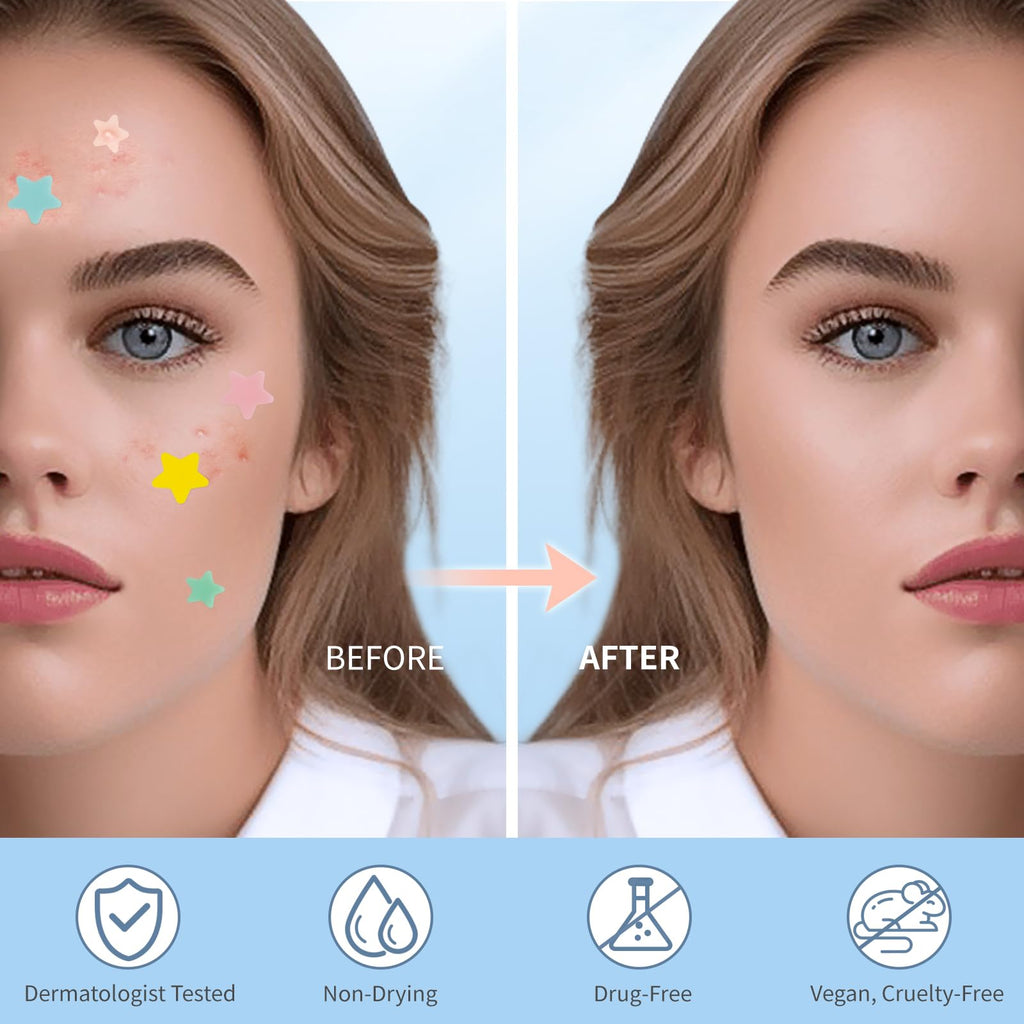 QUSTERE Pimple Patches for Face, Hydrocolloid Acne Patches, Cute Star Zit Covers, Colorful Spot Stickers with Tea Tree, Salicylic Acid & Cica Oil| 3 Sizes (10mm, 12mm & 14mm) |400 Count