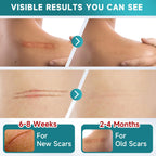 Pumkot Silicone Scar Sheets, Silicone Scar Tape(1.8” x 157” Roll-4M), Medical Grade Scar Removal Away Strips for Surgical Scars, Keloid, C-Section, Burn - Stickiness Upgrade, Waterproof, Reusable