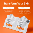 Dr Dennis Gross Alpha Beta Universal Daily Peel: for Uneven Tone or Texture and Fine Lines or Enlarged Pores, (5 Treatments)