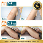 Arme Silicone Scar Tape, 1.6"x480" Silicone Scar Sheets(4 Rolls-12M) Medical Grade Scar Tape for Surgical Scars, Reusable Scar Patches, Professional Scar Removal Strips for C-Section Keloid Tummy Tuck