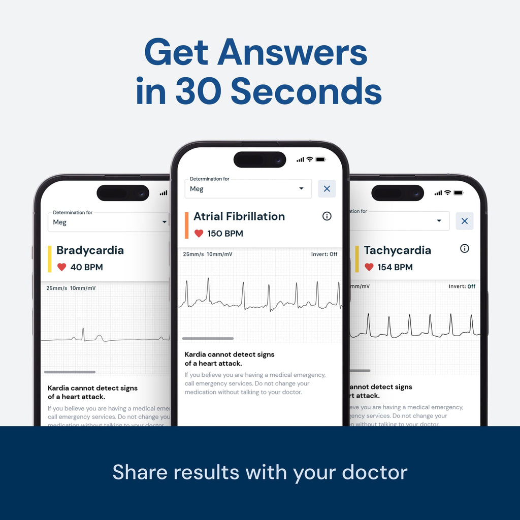 KardiaMobile 1-Lead EKG Monitor, Detects Normal AFib & Arrhythmias, HSA&FSA