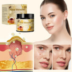 2 Pcs Bee Venom Cream, New Professional Bee Venom Skin Treatment Cream for All Parts of The Body (2.12oz)