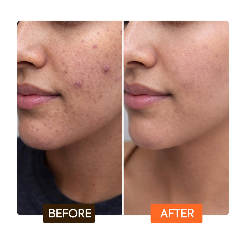 Makari Naturalle Carotonic Extreme Brightening Serum SPF15 (1.7 oz) | Helps Improve the Look of Blemishes & Uneven Areas | Brightening & Smoothing Formula with Antioxidant Support