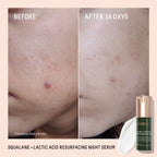 Biossance Rapid Radiance Set, Clean Skincare Gift for Glowing Skin, Valentine’s Day Beauty Gift for Her