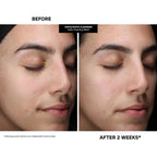 Kate Somerville Pore-fect Skin Edit Travel Kit : ExfoliKate, EradiKate, & Goat Milk Cleanser Holiday Gift Set