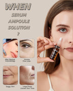 VOFEL Anti Aging Serum with Hyaluronic Acid for Microneedling Serum Ampoules for Face 0.35 oz 4 Vials