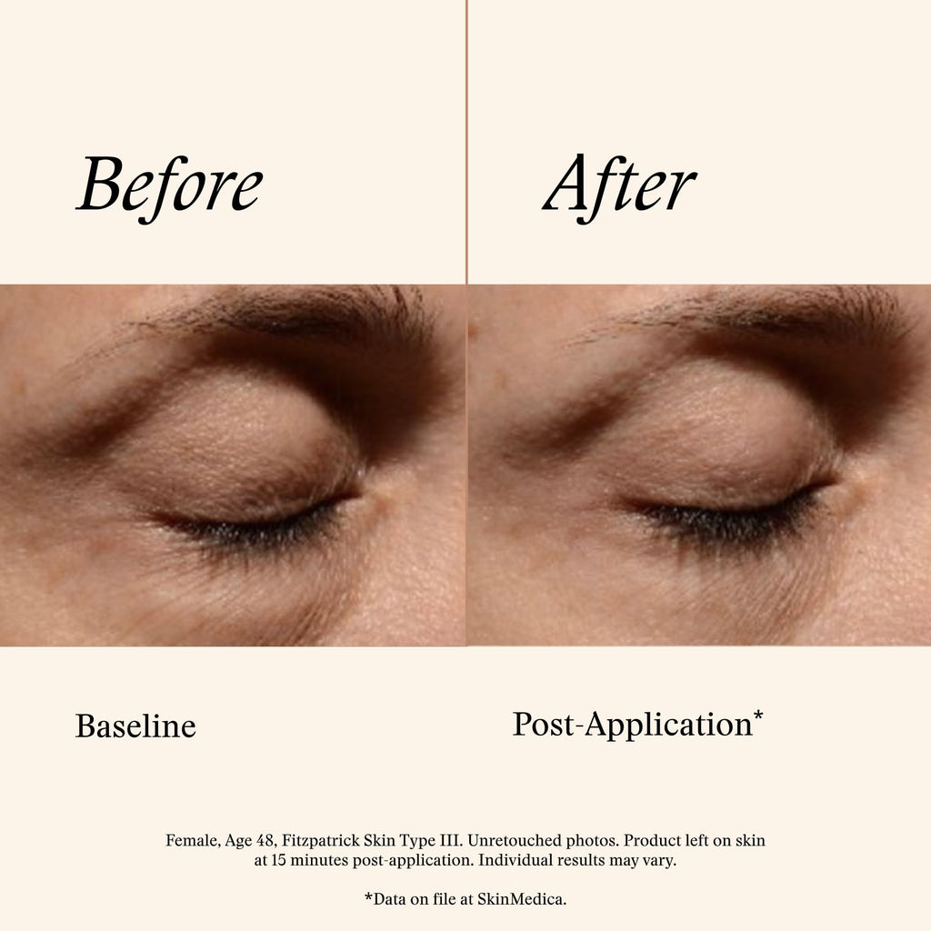 SkinMedica Instant Bright Eye Cream - Our Age-Defying Under the Eye Cream Instantly Improves Eyes’ Appearance, Including Dark Circles, Sagging, Puffiness and Lines, NEW PACKAGING, 0.5 Oz