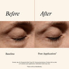 SkinMedica Instant Bright Eye Cream - Our Age-Defying Under the Eye Cream Instantly Improves Eyes’ Appearance, Including Dark Circles, Sagging, Puffiness and Lines, NEW PACKAGING, 0.5 Oz
