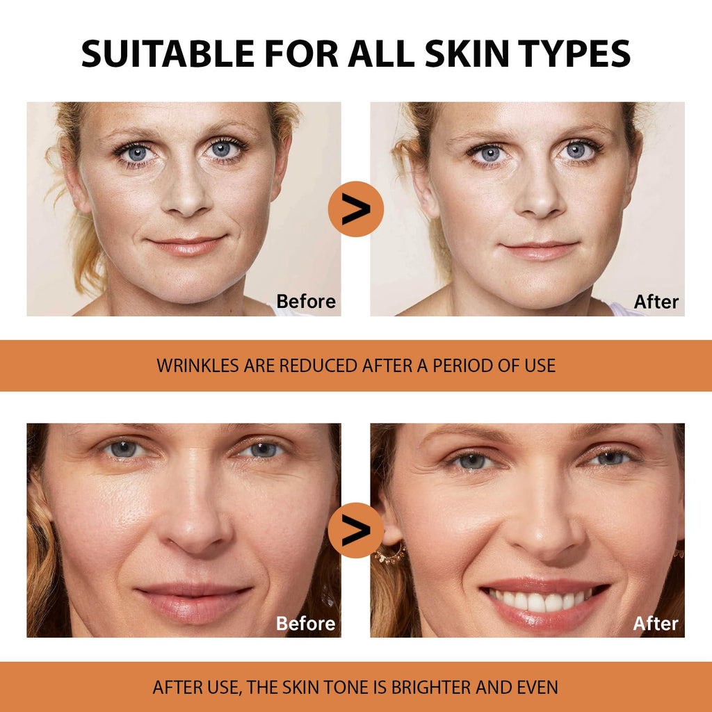 VGO Vitamin C Serum for Face, Vit C Anti Aging Serum with Hyaluronic Acid & Vitamina E, Deep Hydration Facial Care for All Skin Types, 2.02oz / 60ml
