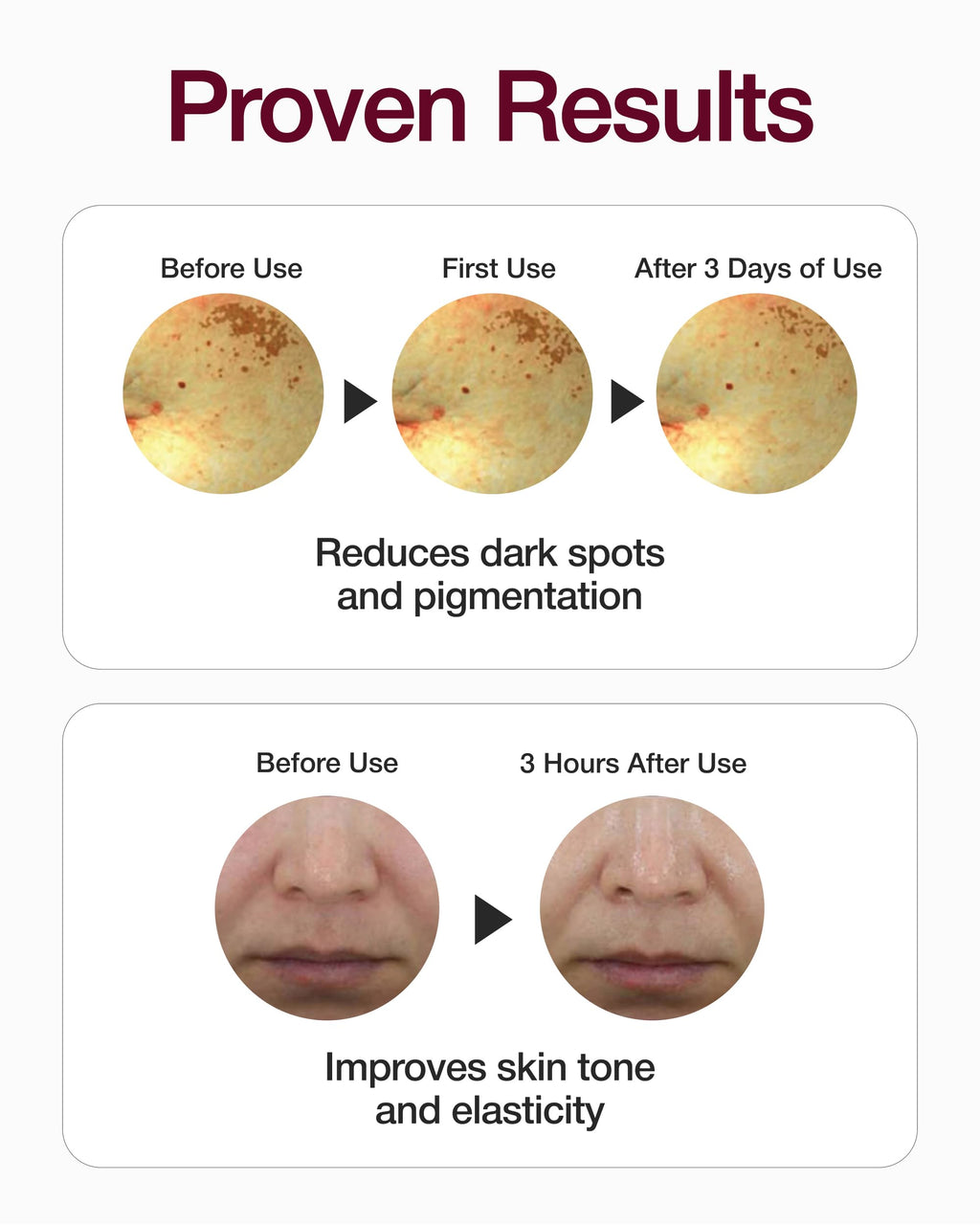 CENTELLIAN 24 Expert Madeca Mela Capture Ampoule Max (Madeca Mela 0.5fl oz) High Concentration Serum for Melanin Reduction, Wrinkle & Enhanced Skin Elasticity - TECA Centella Asiatica Extract
