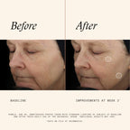 SkinMedica TNS Advanced+ Serum - Our Premium Facial Skin Care Product, the Secret to Flawless Skin. Age-Defying Face Serum for Women is Proven to Address Wrinkles and Fine Lines for Glowing Skin,1 Oz