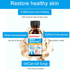 Skin-Tag-Remover, Wart Remover, Mole & Wart-Remover Liquid, Fast-Acting Skin-Tag-Remover for Tag Removal & Verruca-Treatment