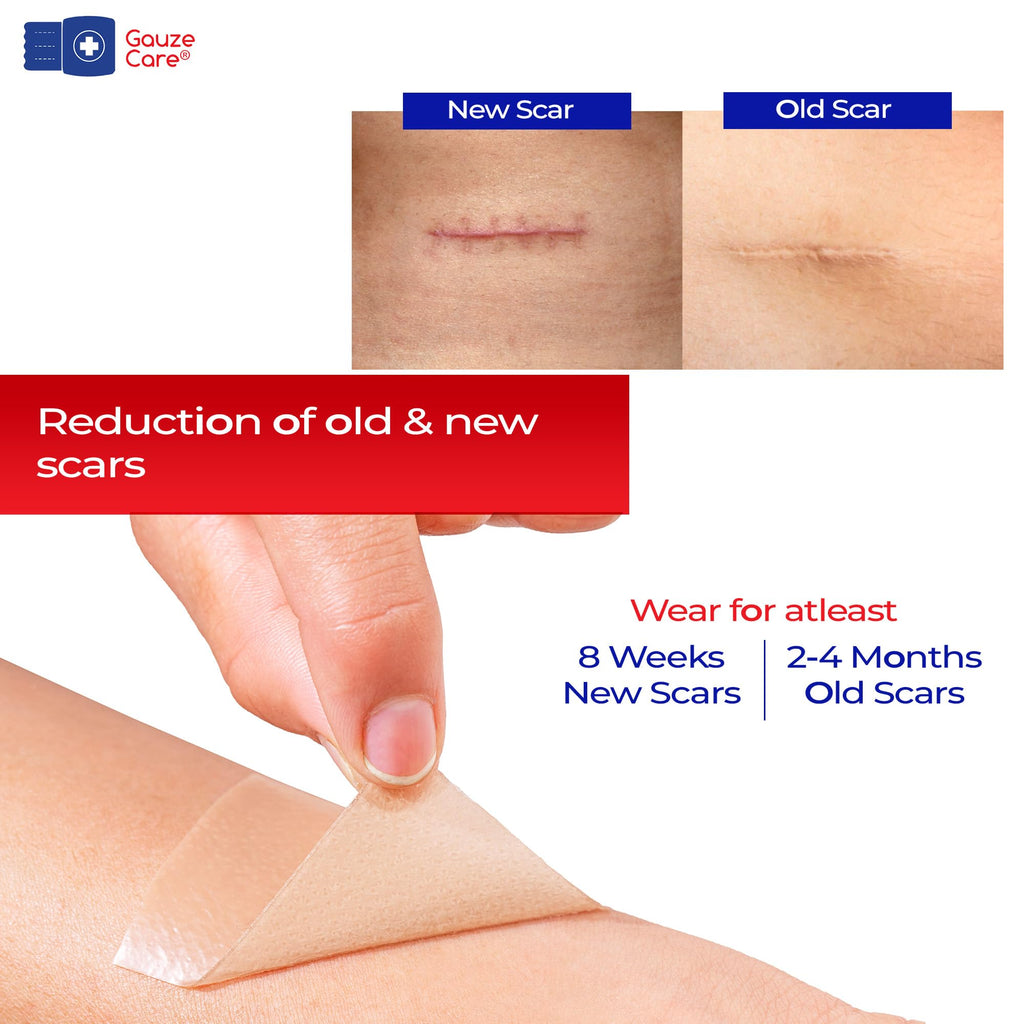 GauzeCare Silicone Scar Tape – 1.6”x150” Roll – Medical-Grade, Reusable, Professional Silicone Scar Tape for surgical scars, C-Section, Burns, Keloid, and Acne Scars