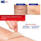 GauzeCare Silicone Scar Tape – 1.6”x150” Roll – Medical-Grade, Reusable, Professional Silicone Scar Tape for surgical scars, C-Section, Burns, Keloid, and Acne Scars