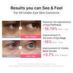medicube Hydrogel Eye Patches with PDRN, Caffeine & Collagen (60 Counts)