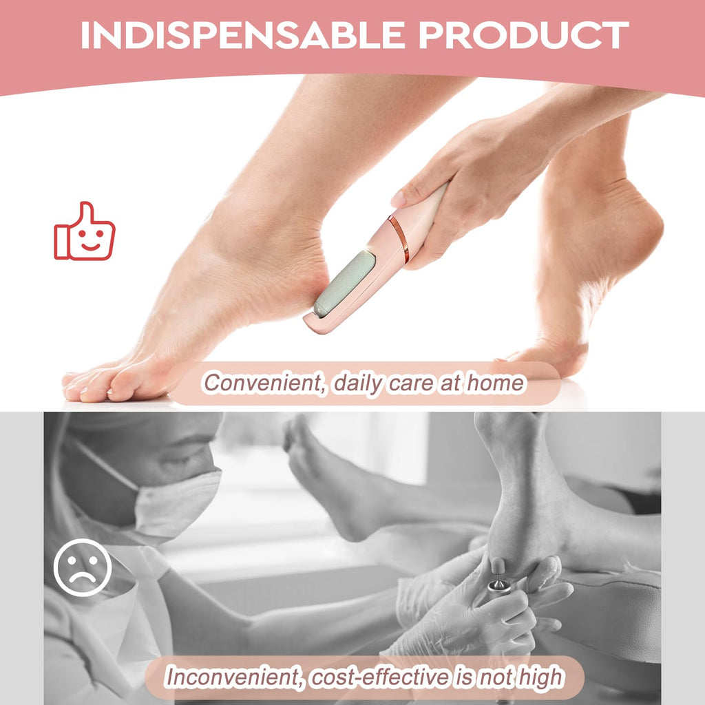 Nuve Smooth Pedicure Wand, Electric Callus Remover for Feet, Portable Smooth Pedicure Stick, Callus Removal Tool, Waterproof, for Treating Dry Cracked Heels, Calluses and Dead Skin.
