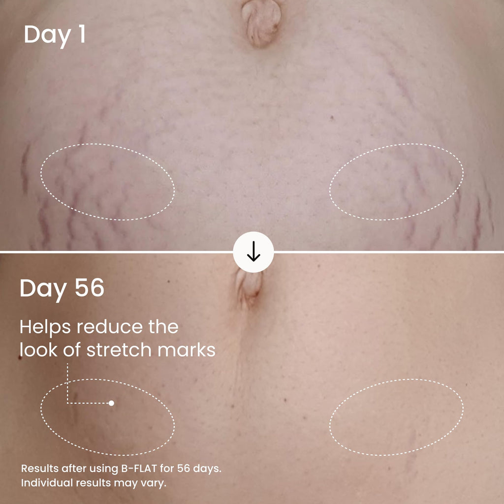 MAËLYS B-FLAT Belly Firming Cream for Women - Skin Tightening & Moisturizing Treatment with Shea Butter & Bentonite Clay - Smooths Look of Stretch Marks - Postpartum Body Care (3.4 Fl Oz)