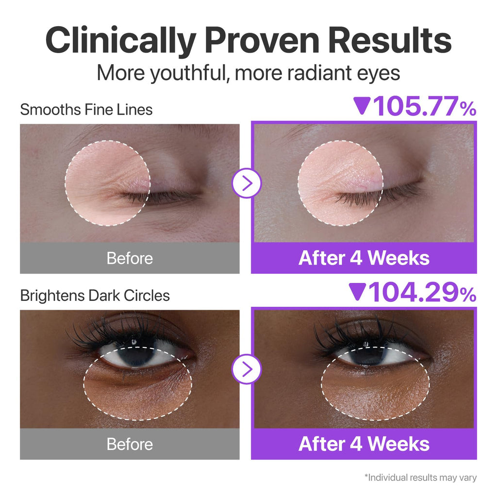 numbuzin No.9 NAD+ Retinol Eye Cream, Depuffing & Firming Eye Serum for Dark Circles, Wrinkles & Fine Lines, Peptides & Niacinamide for Glow & Undereye Radiance, Stocking Stuffers 0.33 fl oz