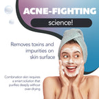 Asepxia Salicylic Acid & Activated Charcoal Bar Soap | Acne Treatment, Reduces Pimples & Blemishes, Deep Cleansing Facial Cleanser, Dries Out Acne, Prevents Breakouts, Face wash, 4 Oz, 5-Pack
