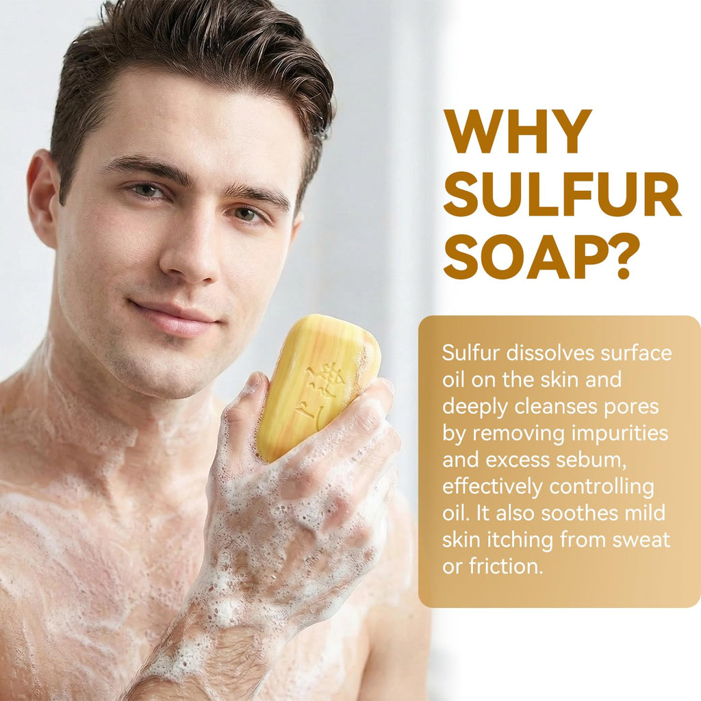 Bee & Flower Shanghai Sulfur Soap 10% Sulfur Soap Bar Face and Body Acne Treatment Sulphur Bar Soaps 3.4 Oz (6 Packs)