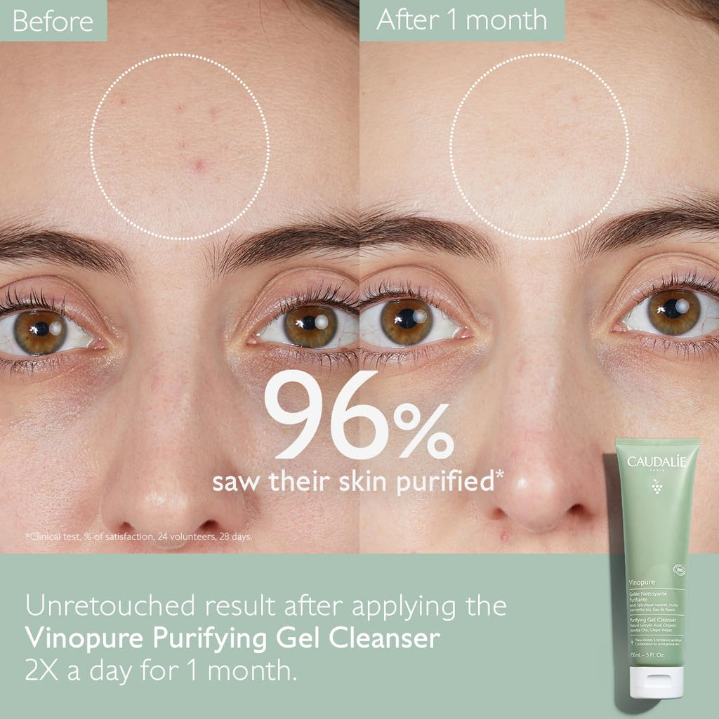 Caudalie Vinopure Salicylic Acid Cleanser, Pore Purifying Gel Cleanser - 150 mL