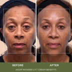 Noor Wonder Lift Cream for Women, Natural Anti-Aging Wrinkle teatment with Syn-Ake natural blend Promotes Anti Aging and Significantly Less Wrinkles In As Little As A Few Days