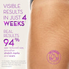 Cicatricure Cica Oil for Stretch Marks & Scars, Visible Results in 4 Weeks, Pregnancy Must-Haves Body Oil with Vitamin E, Stretch Mark Oil, Scar Treatment with Botanical Ingredients, 6.7 fl oz
